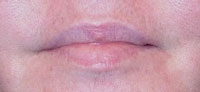 My bare lips before DuWop Lip Venom application. 